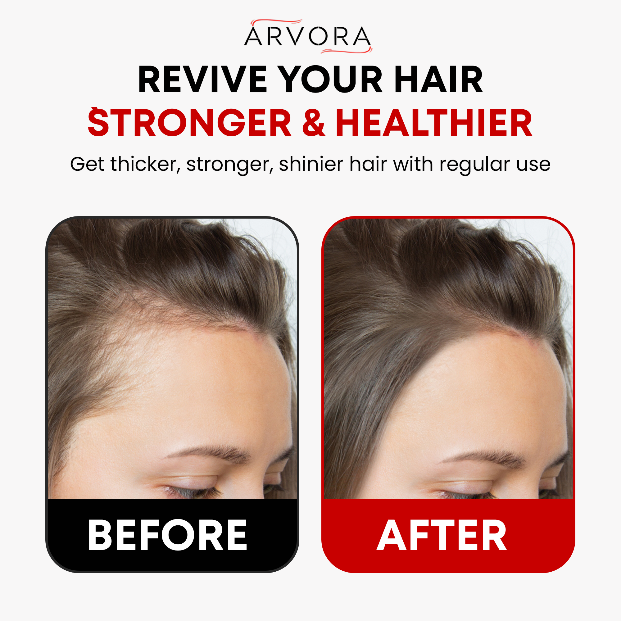 Arvora™ 3-in-1 Scalp & Revival Brush